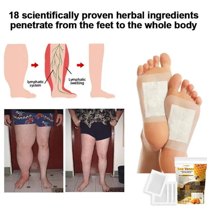 Bee Venom Lymphatic Drainage & Slimming Foot Patches (Set of 60) 🐝 Buy 1 Get 1 FREE! 🌿👣