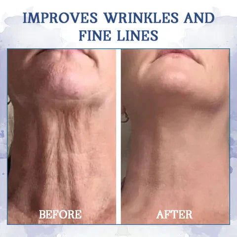 LOVILDS® Advanced Firming & Wrinkle-Reducing Cream: Restore Skin Elasticity